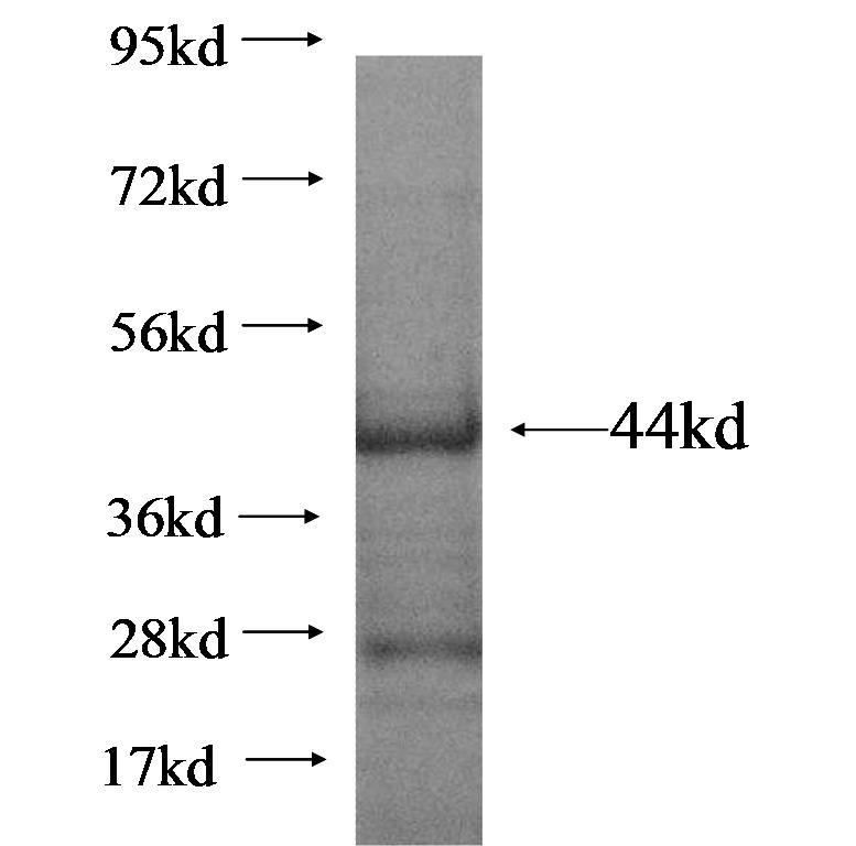 LRRC41 fusion protein Ag17025 SDS-PAGE LRRC41 fusion protein Ag17025 SDS-PAGE