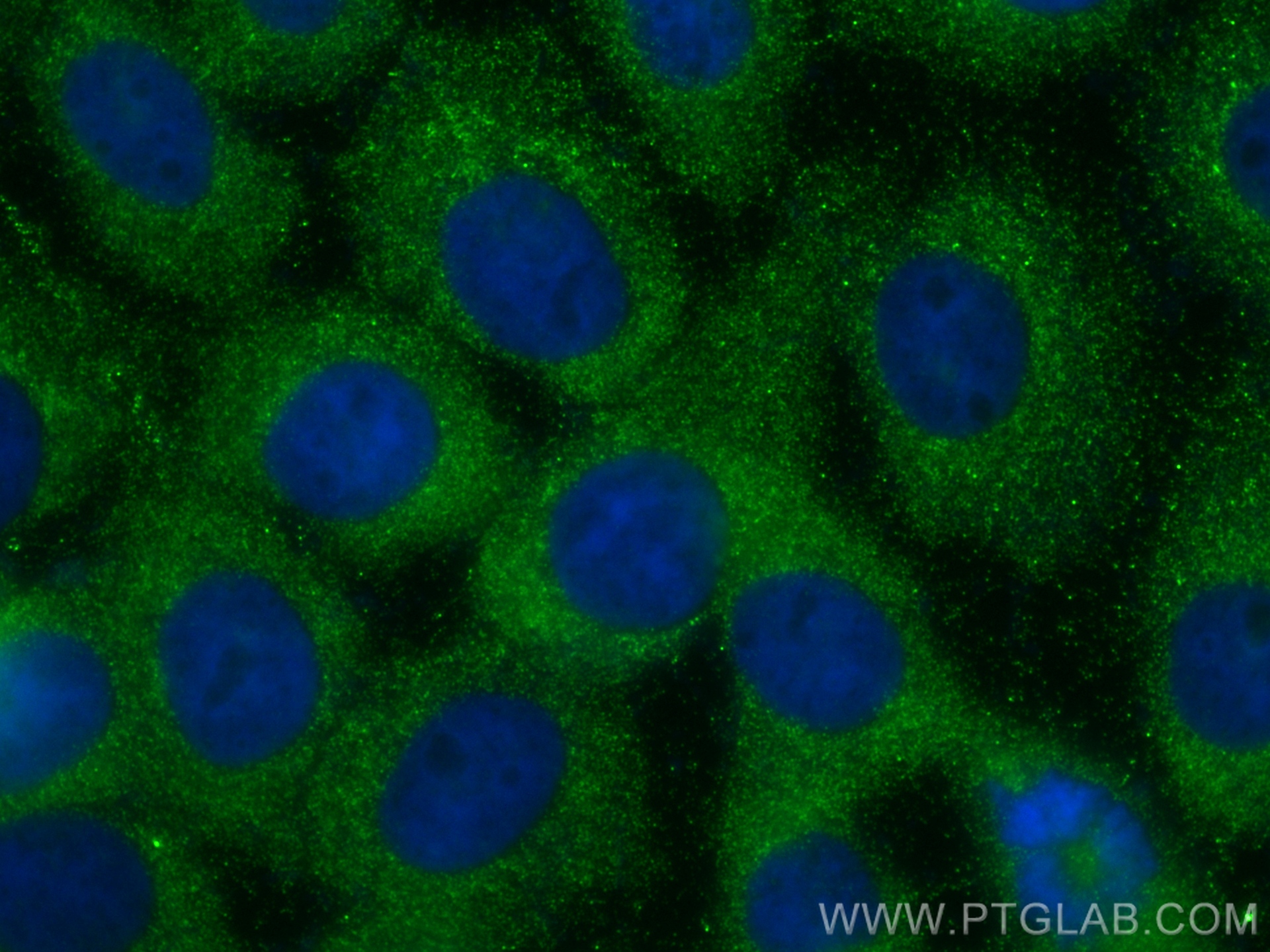 IF Staining of A431 using 32111-1-AP