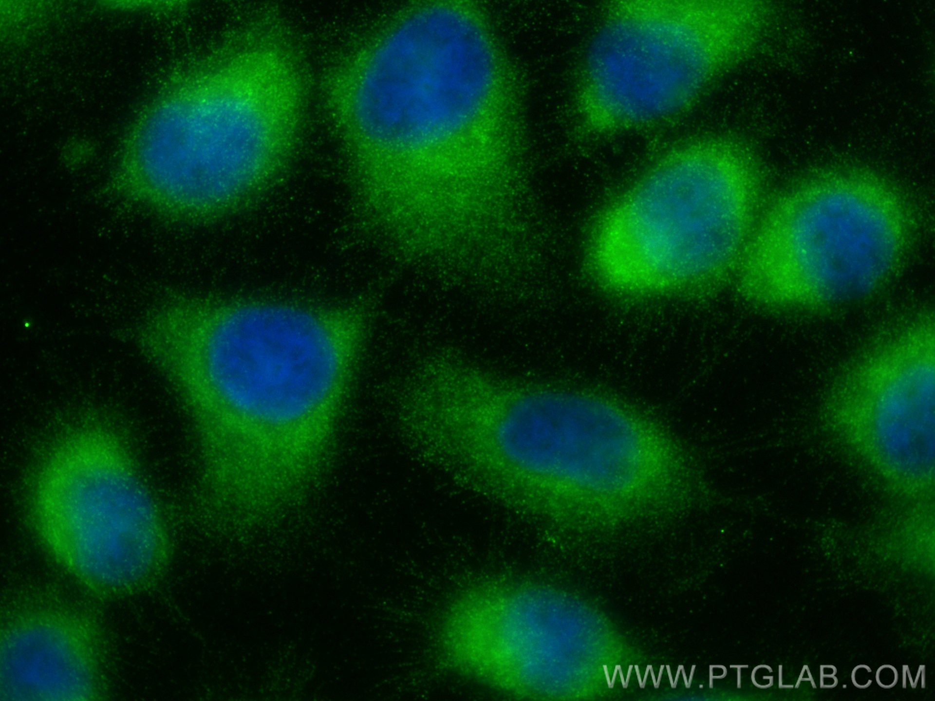 IF Staining of U-251 using 32111-1-AP