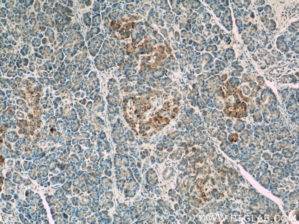 IHC staining of human pancreas using 23217-1-AP