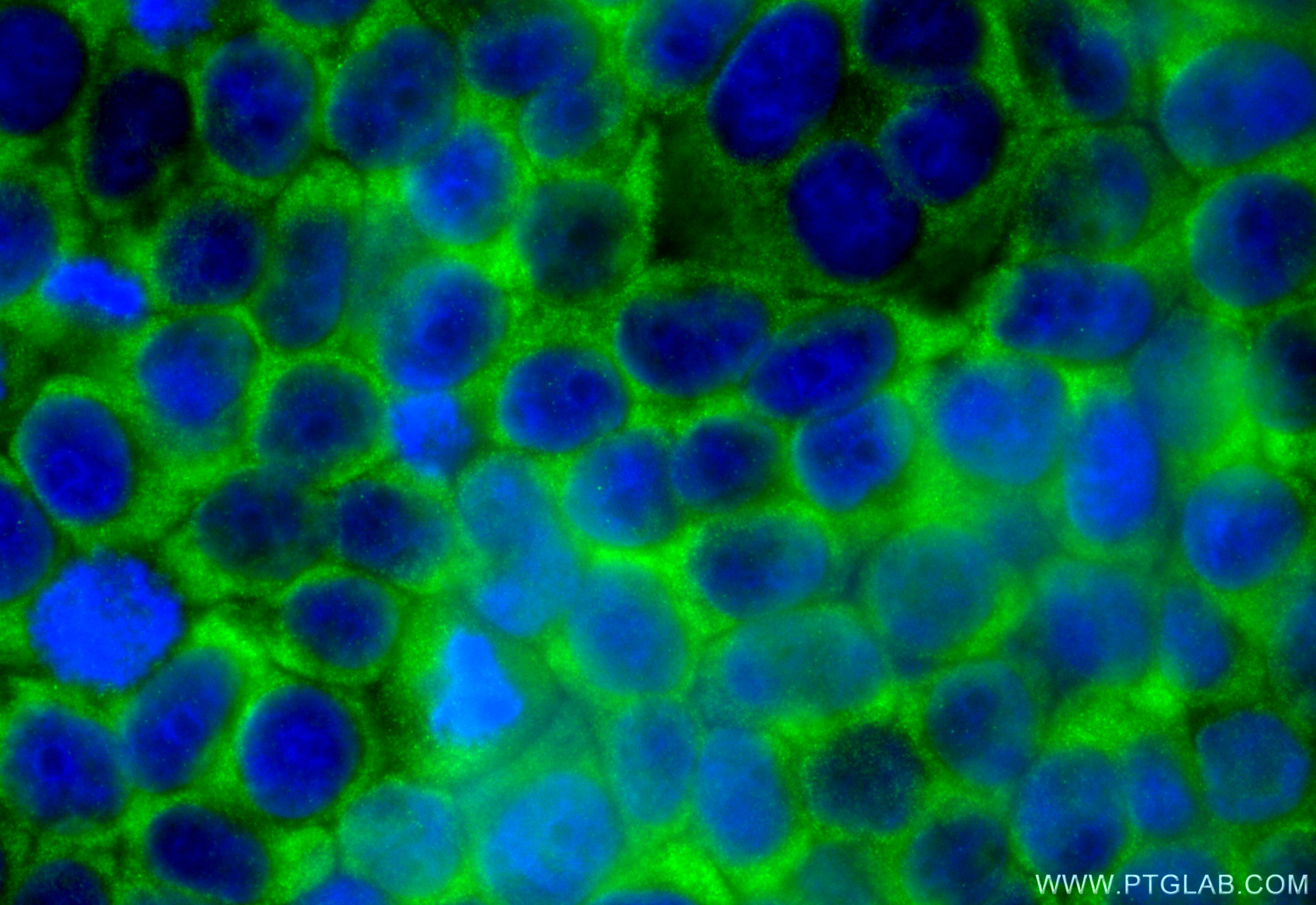 IF Staining of L02 using 83693-3-RR