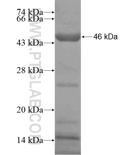 LRRC47 fusion protein Ag20031 SDS-PAGE LRRC47 fusion protein Ag20031 SDS-PAGE