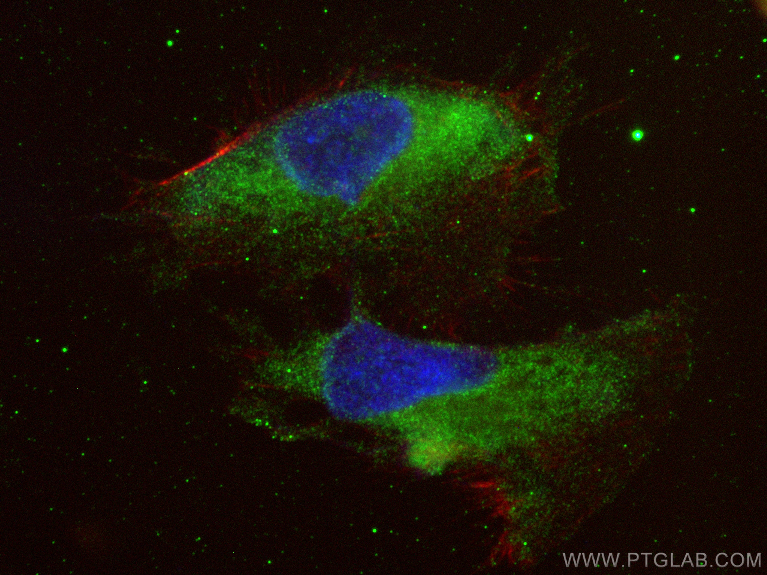 IF Staining of U-251 using 27796-1-AP (same clone as 27796-1-PBS)