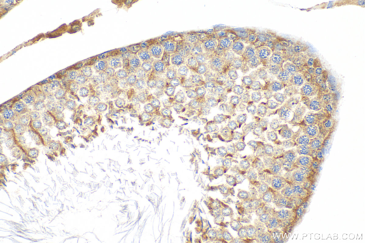 IHC staining of rat testis using 27796-1-AP (same clone as 27796-1-PBS)