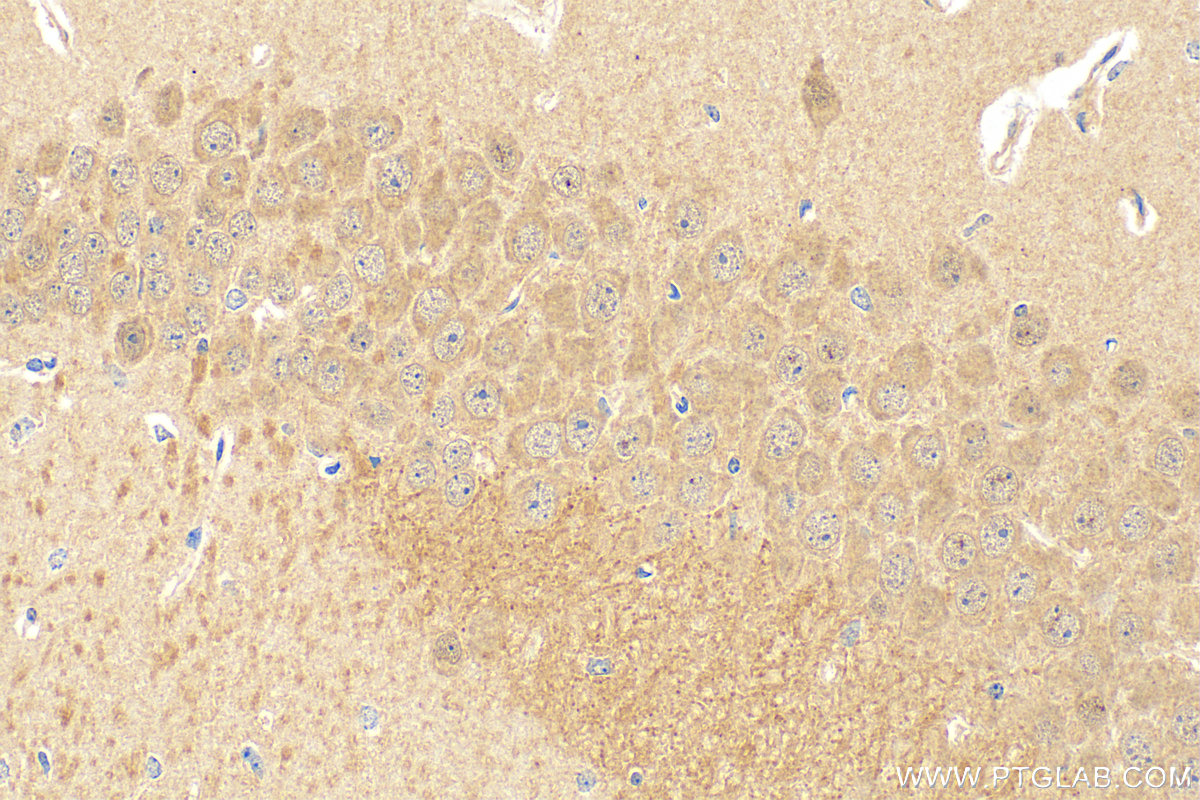 IHC staining of mouse brain using 27796-1-AP (same clone as 27796-1-PBS)