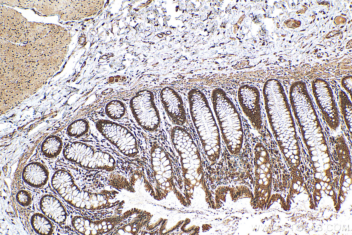 IHC staining of human colon using 27208-1-AP