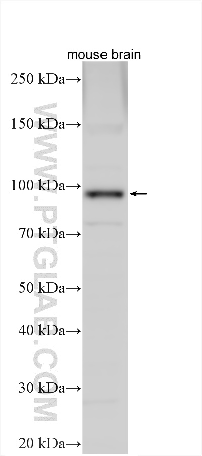 Mouse brain tissue were subjected to SDS PAGE followed by western blot with 17155-1-AP (LRRC8A/SWELL1 antibody) at dilution of 1:500 incubated at room temperature for 1.5 hours. WB analysis using 17155-1-AP
