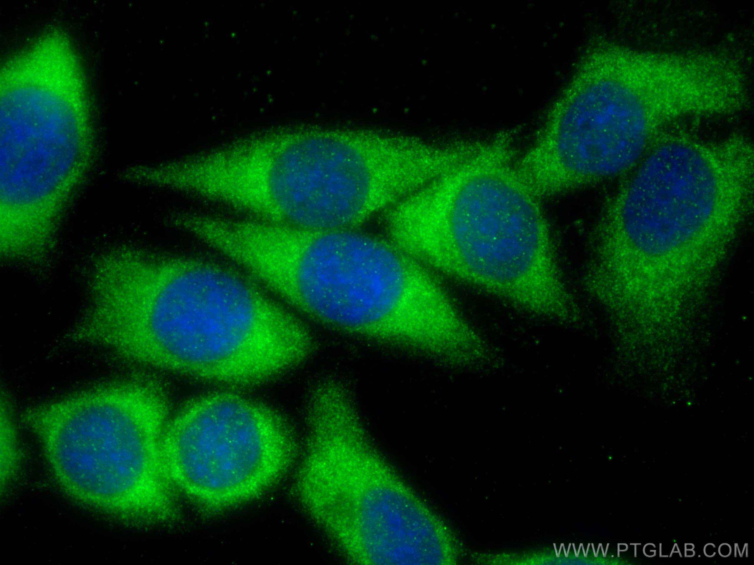 IF Staining of HepG2 using 21601-1-AP