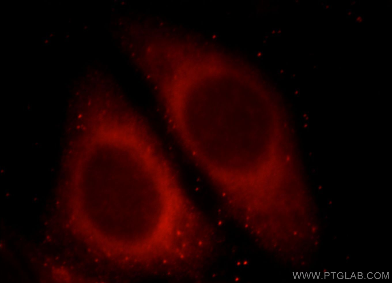 IF Staining of HepG2 using 21601-1-AP