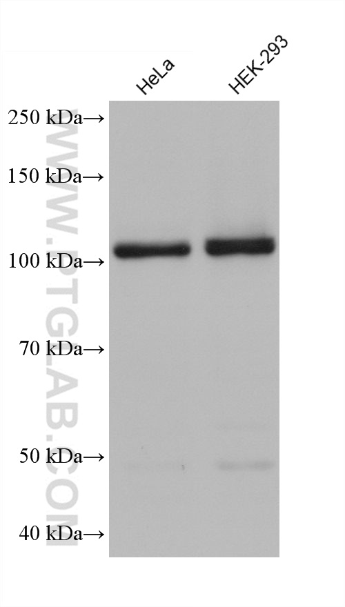 WB analysis using 68323-1-Ig (same clone as 68323-1-PBS)
