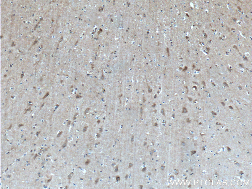 IHC staining of human brain using 11537-1-AP