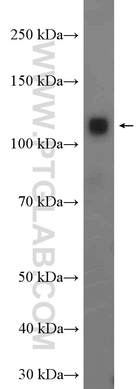 WB analysis of mouse brain using 11537-1-AP