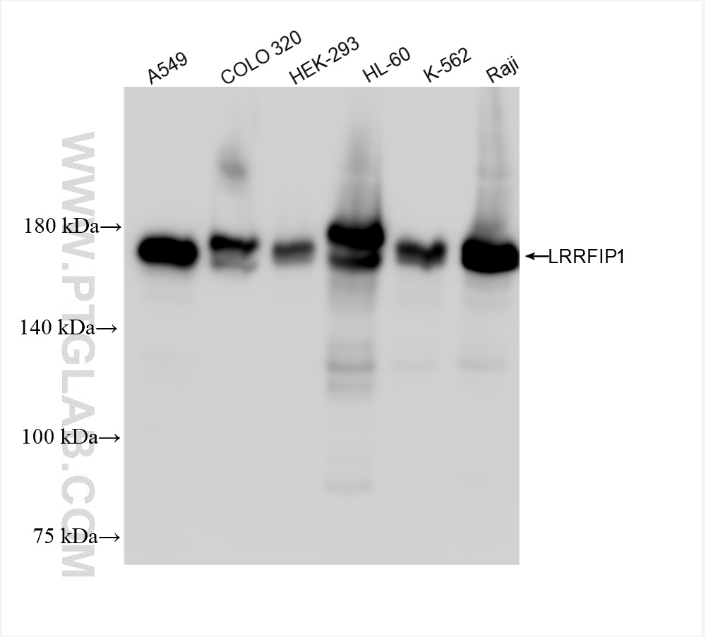 WB analysis using 84778-4-RR (same clone as 84778-4-PBS)