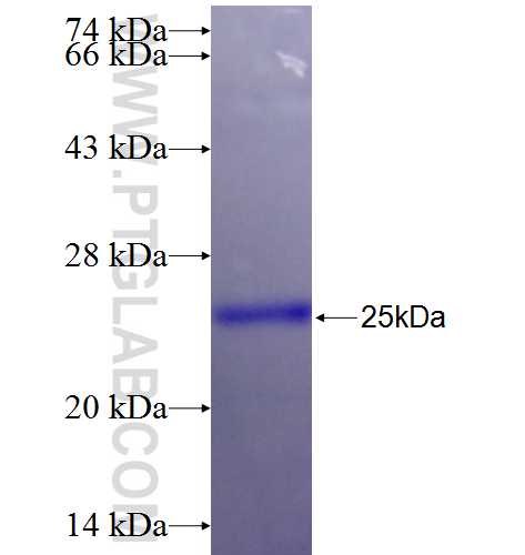 LRRFIP2 fusion protein Ag26374 SDS-PAGE LRRFIP2 fusion protein Ag26374 SDS-PAGE