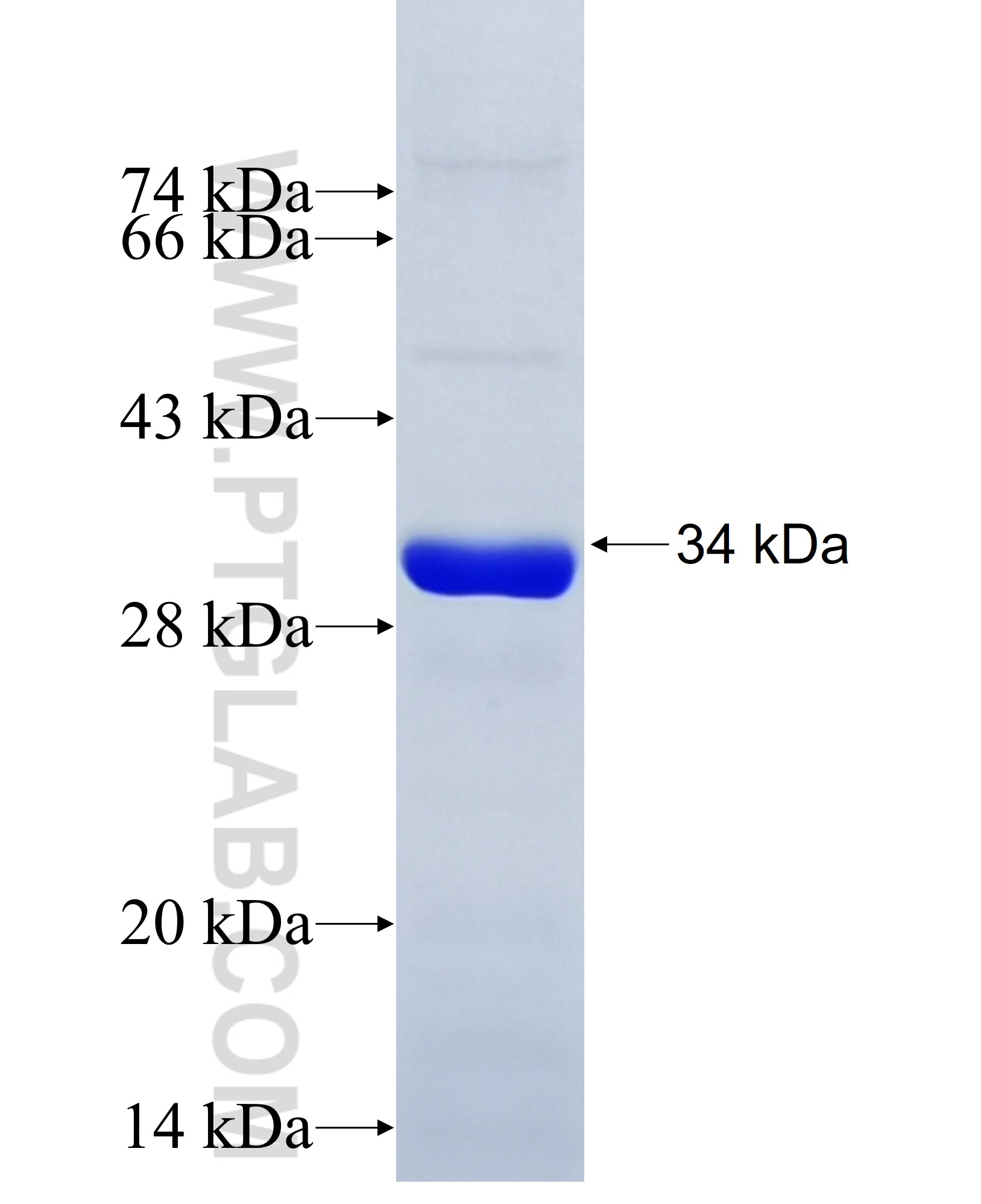 LRRK1 fusion protein Ag34939 SDS-PAGE LRRK1 fusion protein Ag34939 SDS-PAGE