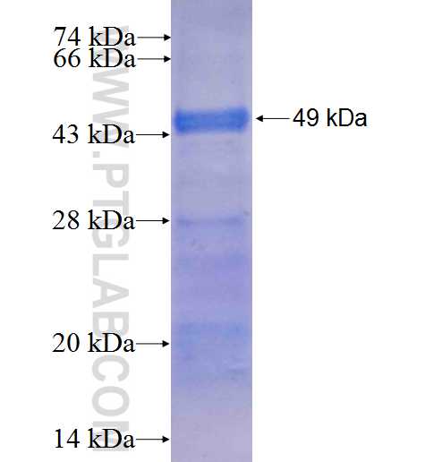 LRRK1 fusion protein Ag7786 SDS-PAGE LRRK1 fusion protein Ag7786 SDS-PAGE