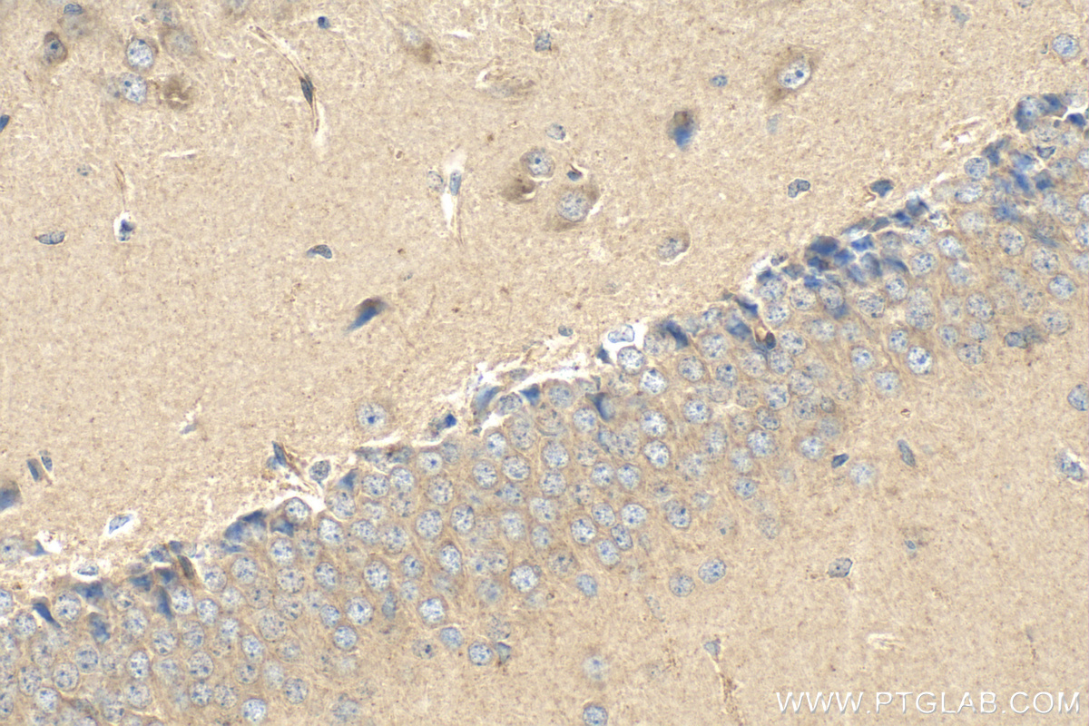 IHC staining of mouse brain using 25793-1-AP