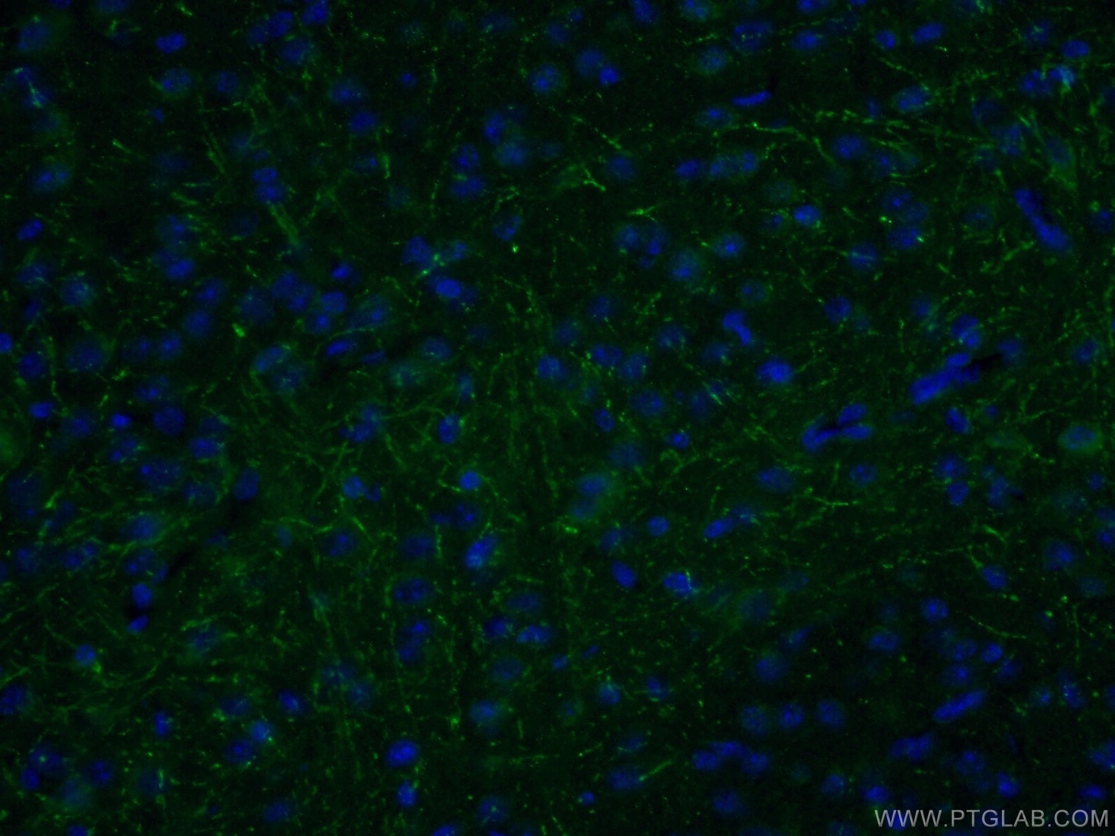 IF Staining of mouse brain using 14288-1-AP