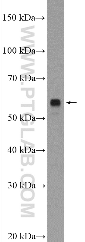 WB analysis of mouse spinal cord using 23094-1-AP