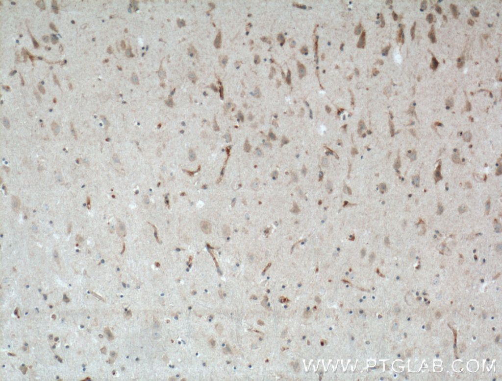 IHC staining of human brain using 27003-1-AP