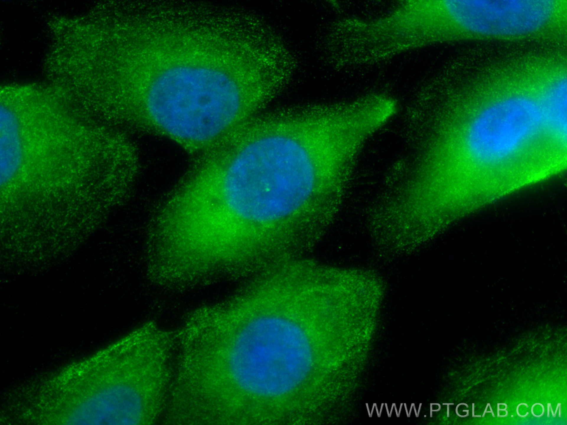 IF Staining of A431 using 24666-1-AP