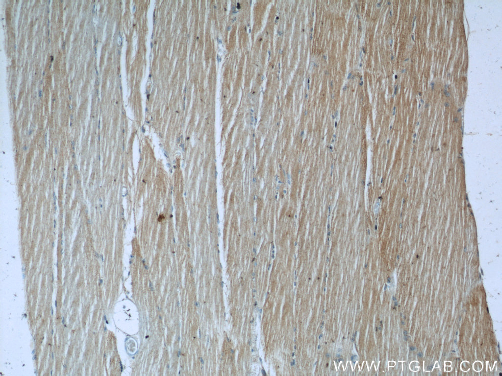 IHC staining of human skeletal muscle using 24666-1-AP