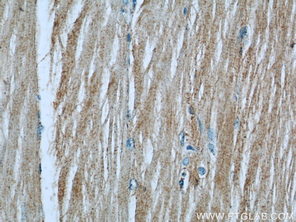 IHC staining of human skeletal muscle using 24666-1-AP