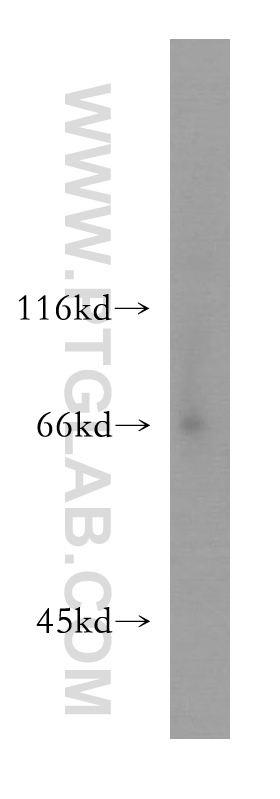WB analysis of human brain using 13600-1-AP (same clone as 13600-1-PBS)