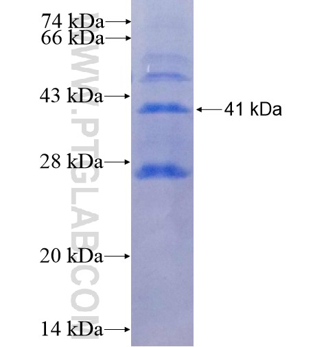 LSAMP fusion protein Ag14474 SDS-PAGE LSAMP fusion protein Ag14474 SDS-PAGE