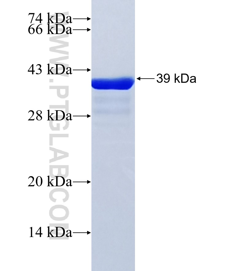 LSDP5 fusion protein Ag25272 SDS-PAGE