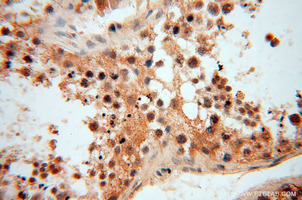 IHC staining of human testis using 17750-1-AP