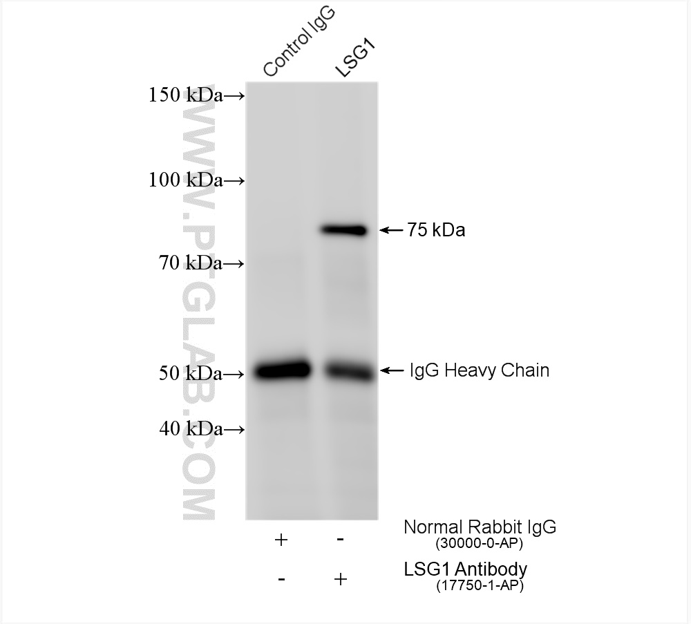 IP experiment of HeLa using 17750-1-AP