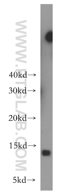 WB analysis of human spleen using 10874-1-AP