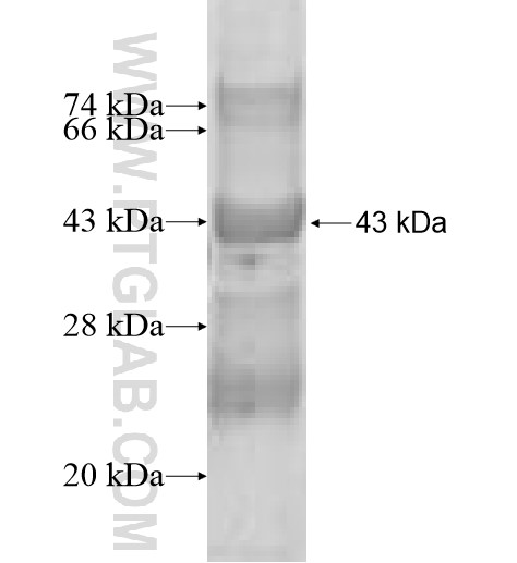 LSM12 fusion protein Ag10150 SDS-PAGE LSM12 fusion protein Ag10150 SDS-PAGE