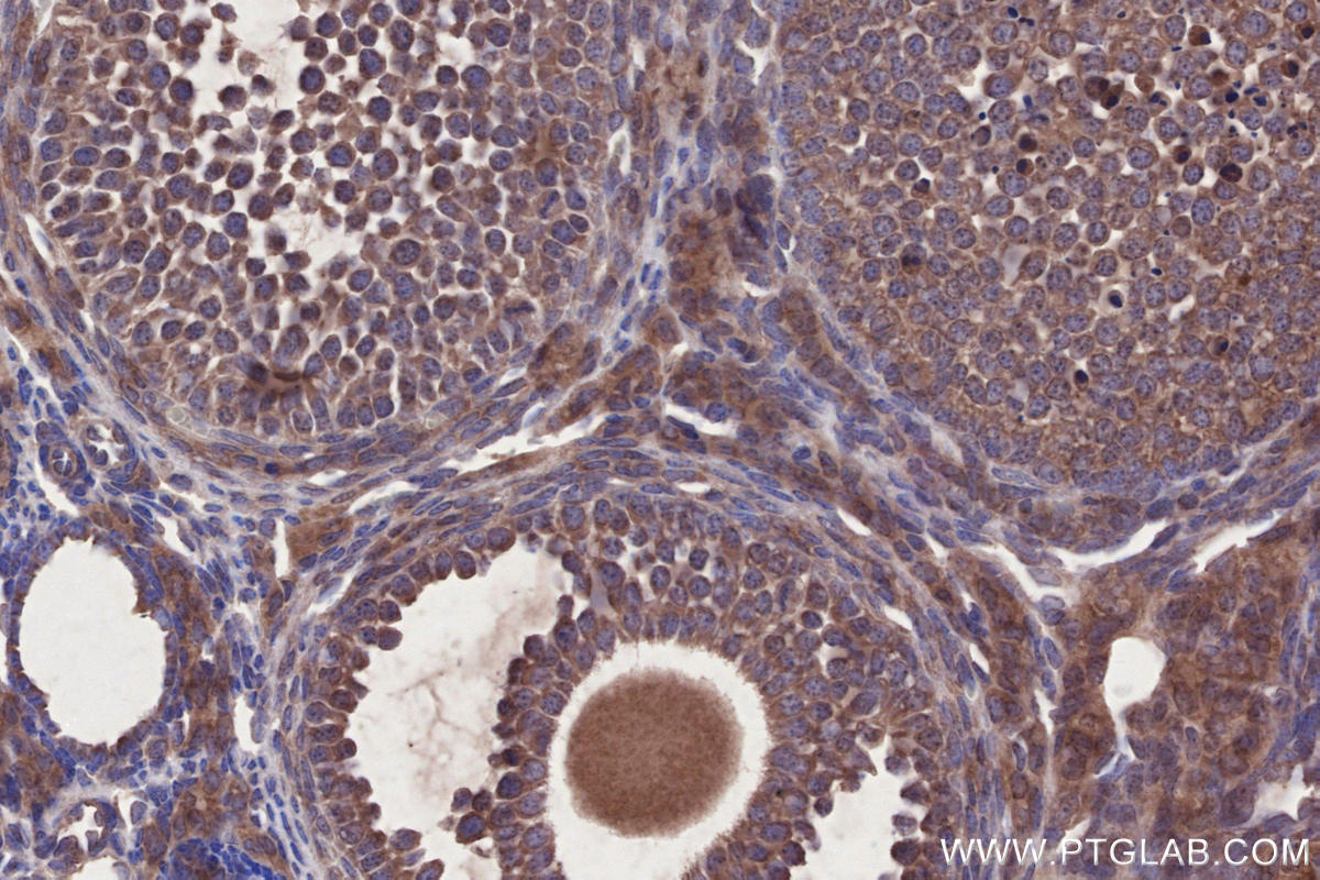 IHC staining of mouse ovary using 18336-1-AP IHC staining of mouse ovary using 18336-1-AP