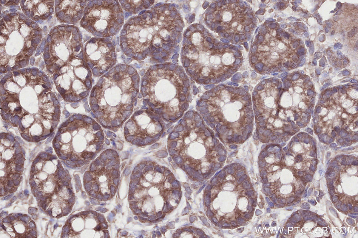 IHC staining of rat colon using 18336-1-AP IHC staining of rat colon using 18336-1-AP
