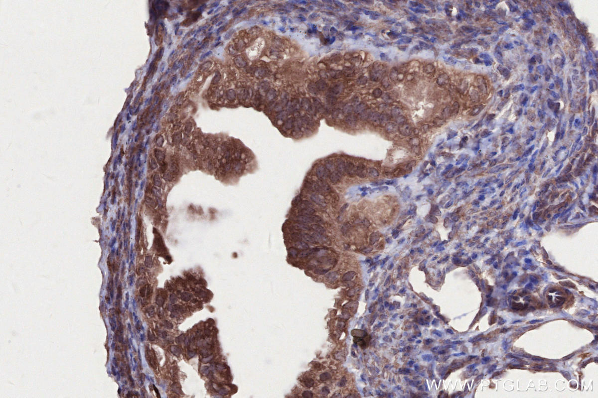 IHC staining of mouse ovary using 18336-1-AP IHC staining of mouse ovary using 18336-1-AP