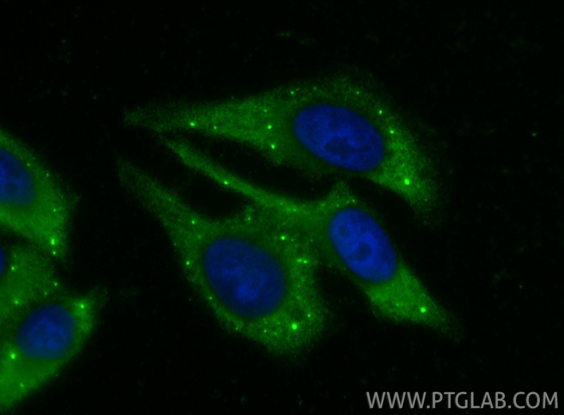 IF Staining of HepG2 using 33966-1-AP