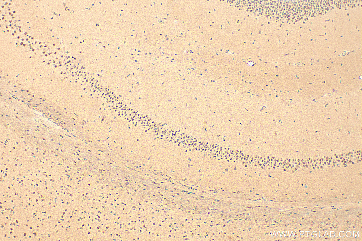 IHC staining of mouse brain using 10963-1-AP