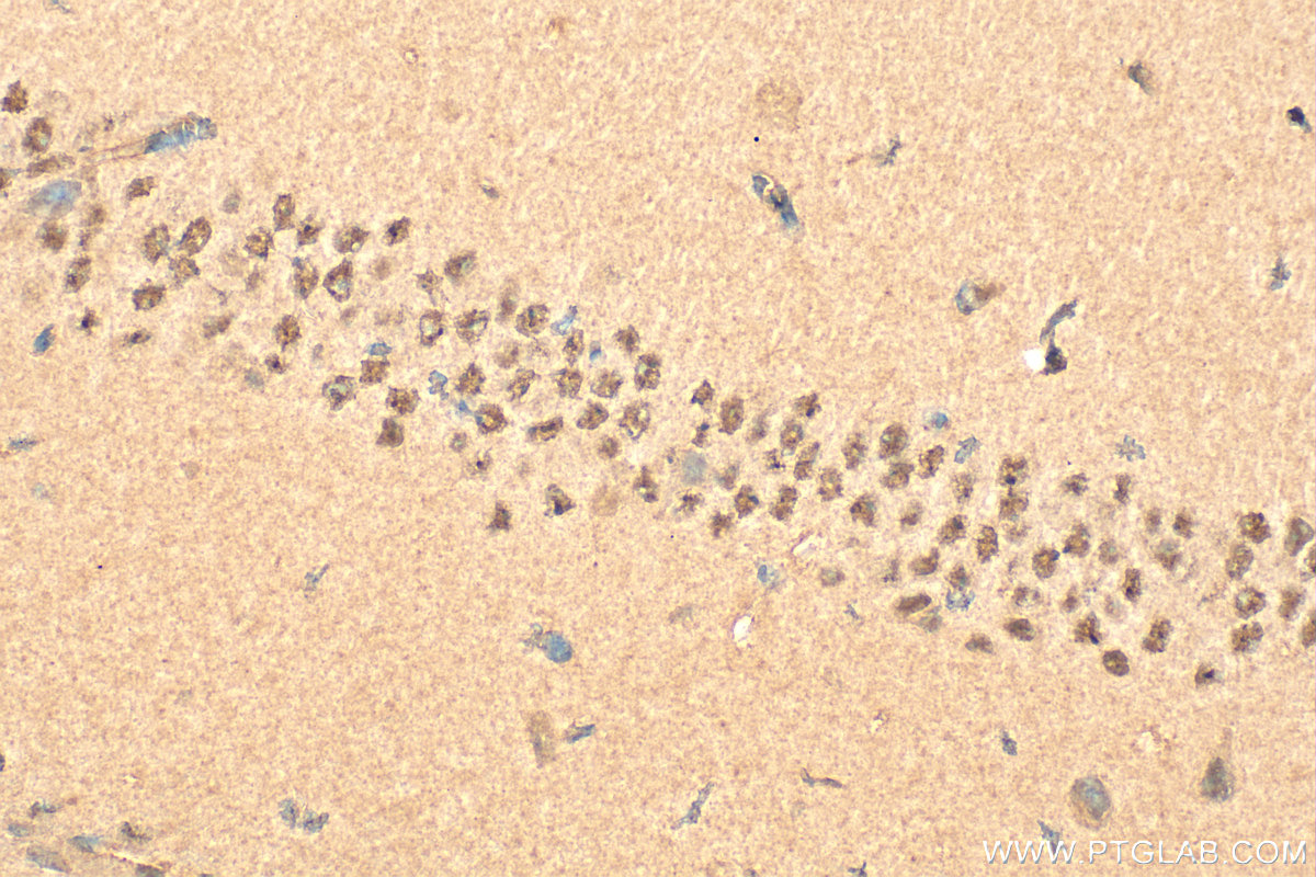 IHC staining of mouse brain using 10963-1-AP