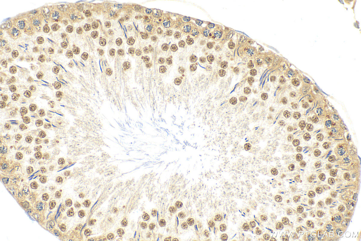 IHC staining of rat testis using 15879-1-AP