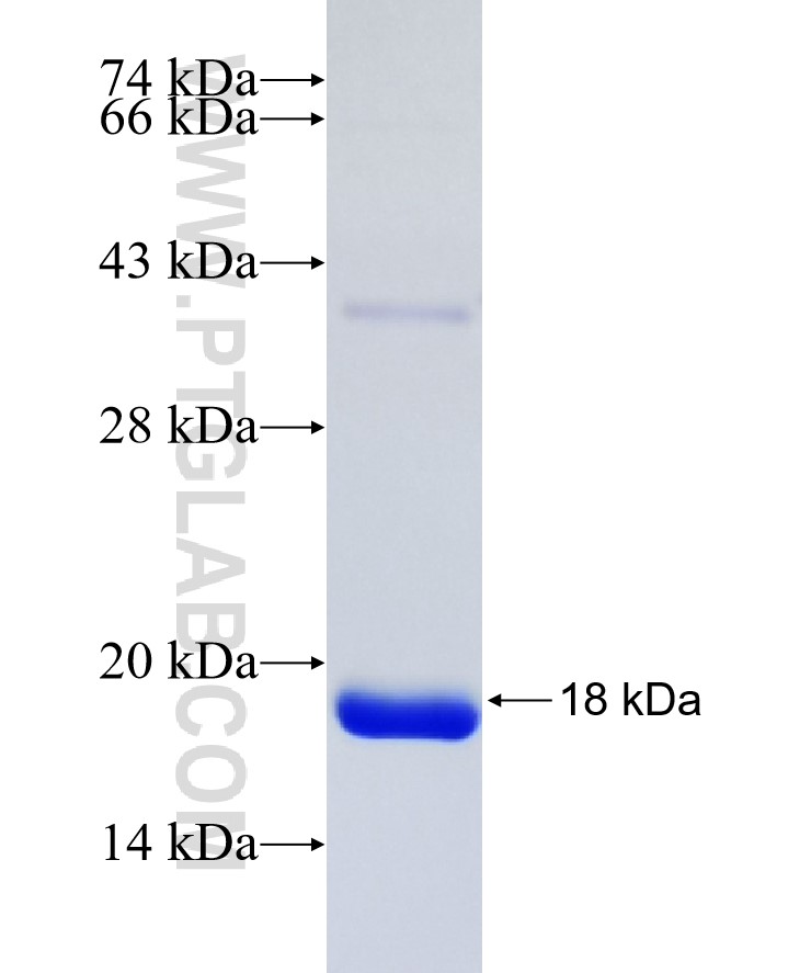 LSM3 fusion protein Ag8570 SDS-PAGE