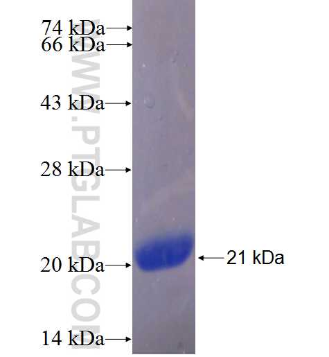 LSM4 fusion protein Ag24435 SDS-PAGE LSM4 fusion protein Ag24435 SDS-PAGE