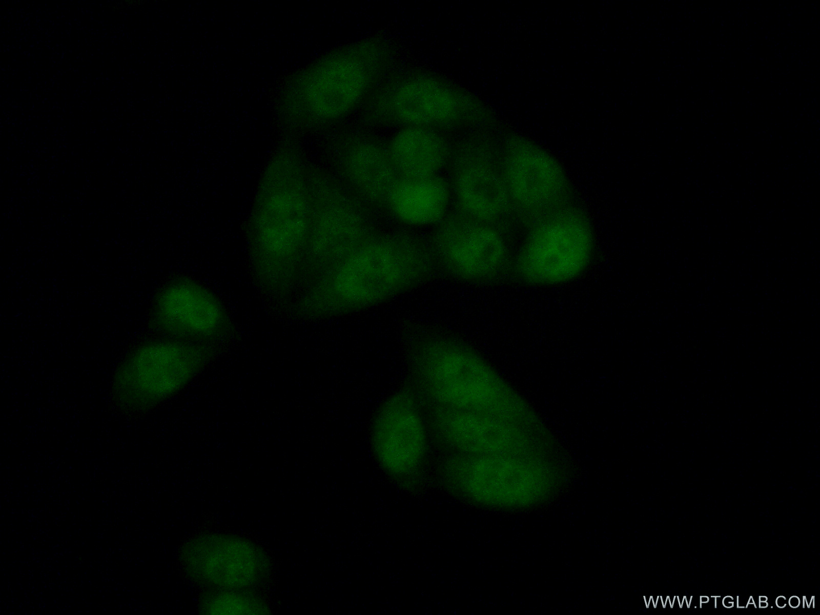 IF Staining of HeLa using 10700-1-AP