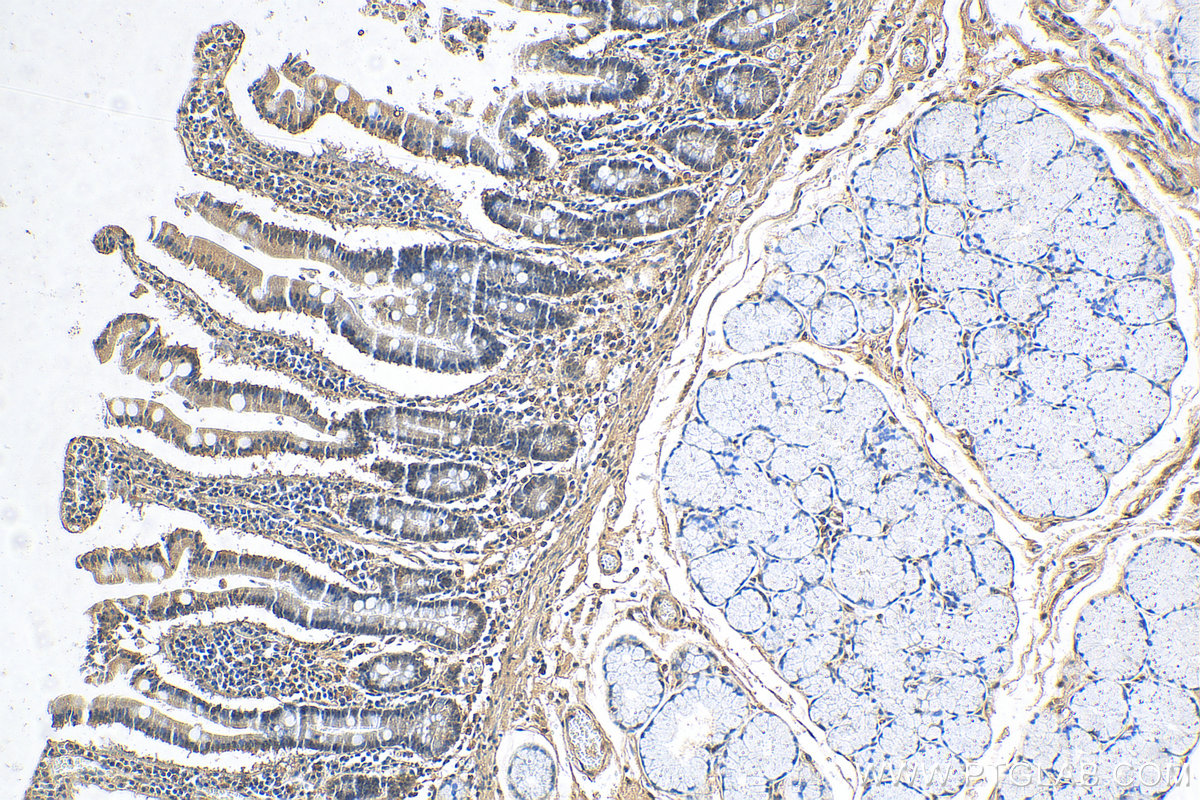 IHC staining of human stomach using 12138-1-AP