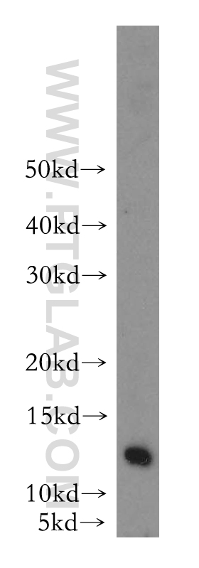 WB analysis of HeLa using 18941-1-AP (same clone as 18941-1-PBS)