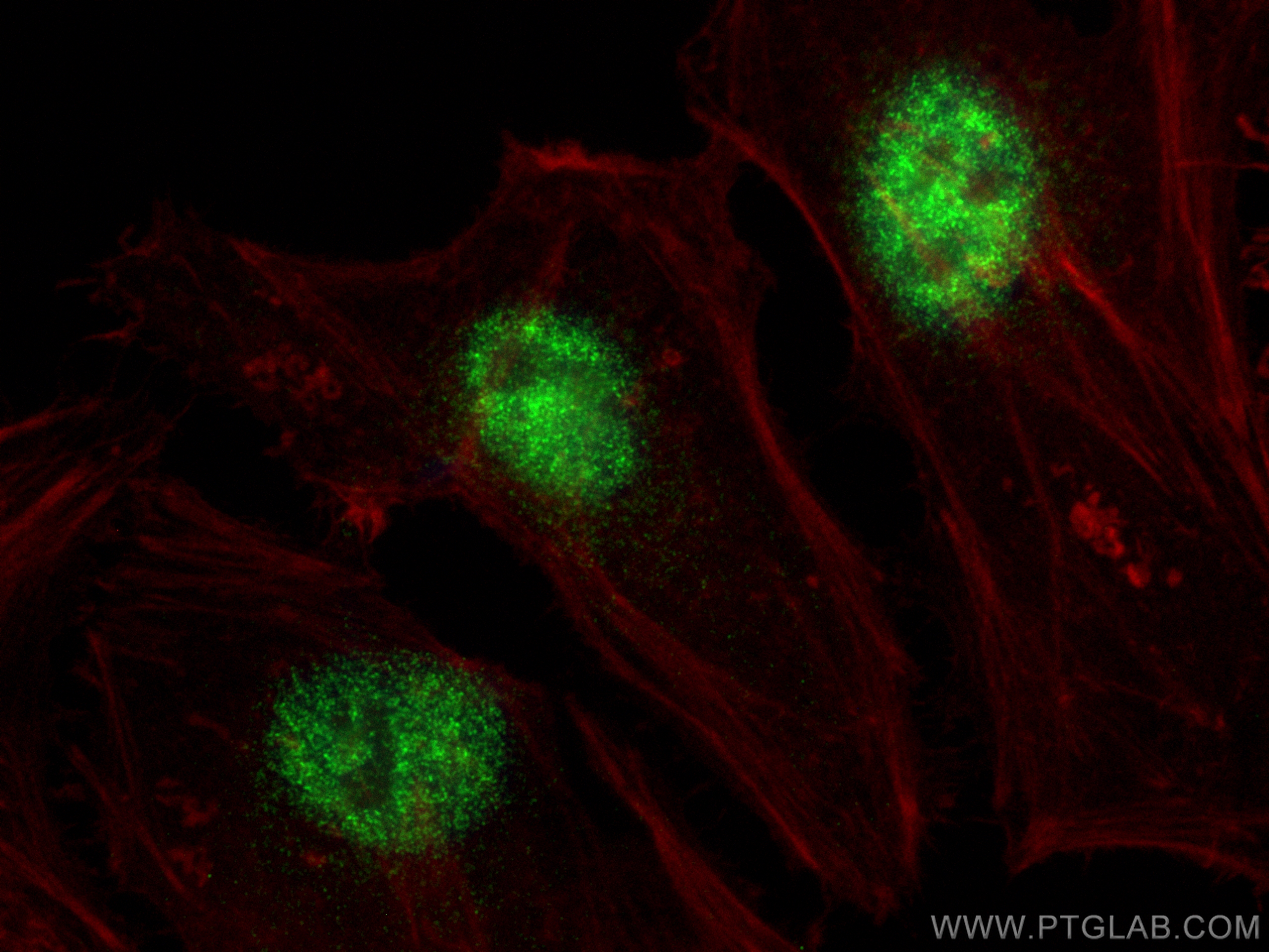 IF Staining of HeLa using 10134-1-AP