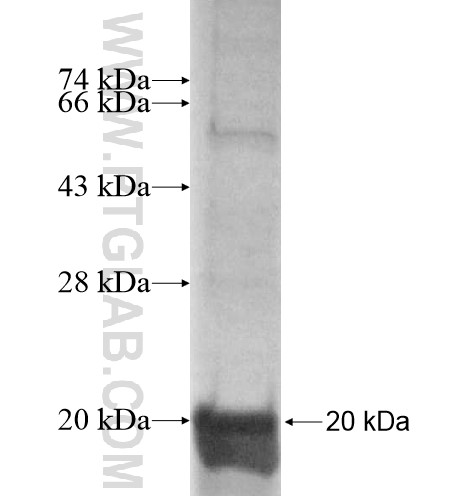 LSMD1 fusion protein Ag15132 SDS-PAGE LSMD1 fusion protein Ag15132 SDS-PAGE