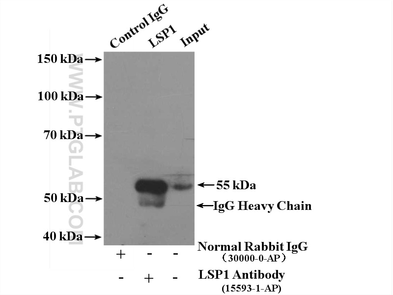 IP experiment of Raji using 15593-1-AP