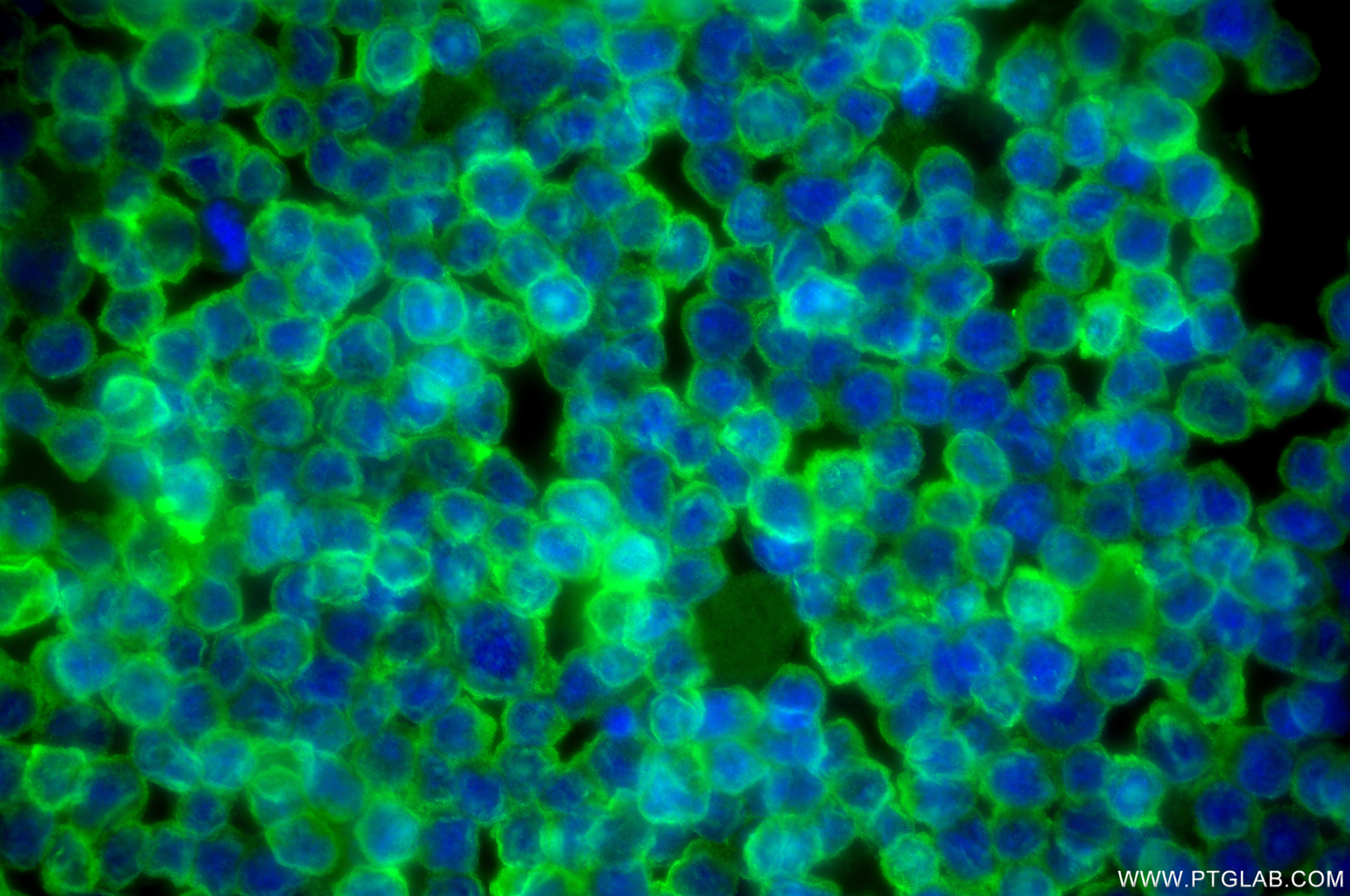 IF Staining of Daudi using 87378-1-RR